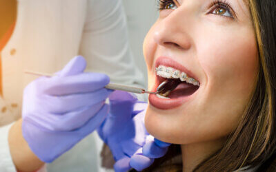 Adult Orthodontics in Utah: Your Questions Answered by Red Rock Orthodontics